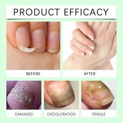 Nail Care Solution