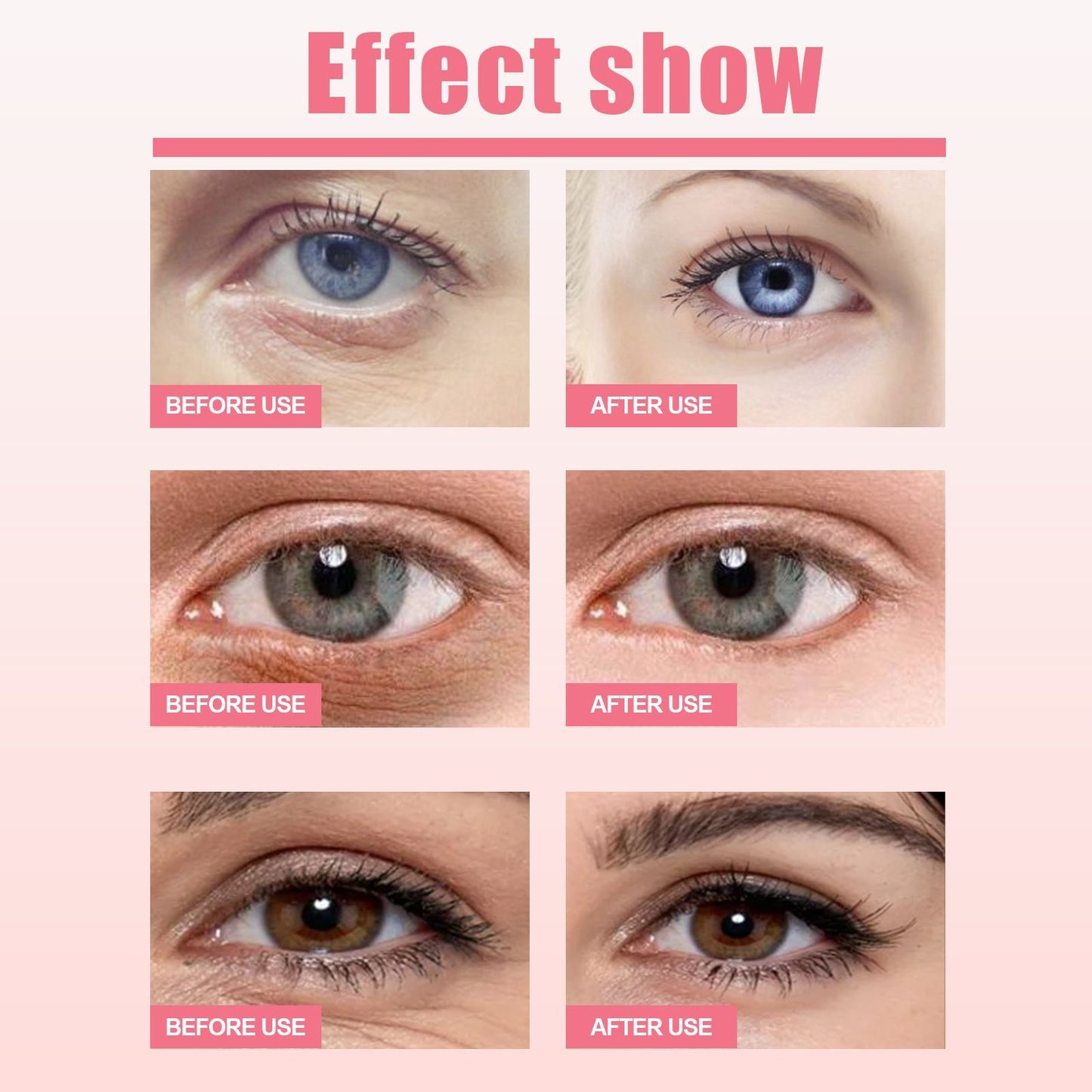 West&Month Rosehip Eye Cream Stick For Periocular Moisturization, Hydration, Fine Line Reduction, Dark Circle Mitigation, And Lifting And Firming The Eye Area