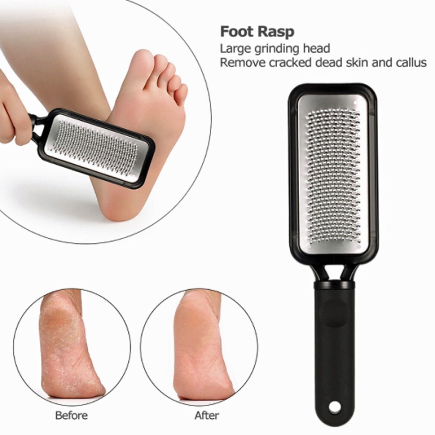 Foot File Scraper Rasp Hard Dead Dry Skin Remover Grater Callus Pedicure Black