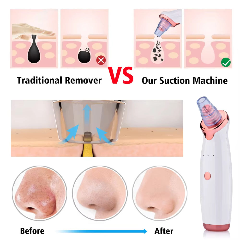 Blackhead Remover Pore Acne Pimple Removal Face T Zone Nose Water Bubble Cleaner Vacuum Suction Facial Diamond Steamer Oil Dirty