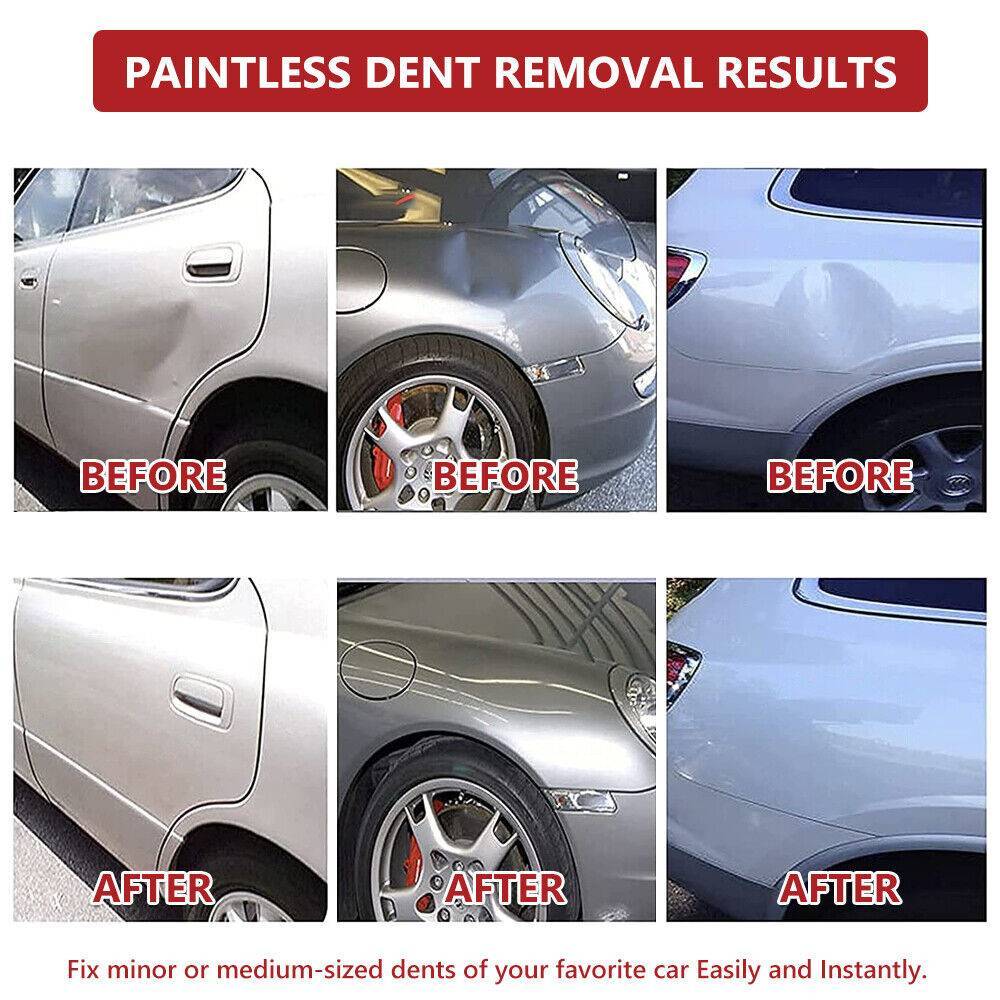 35PC Paintless Auto Car Body Kit Dent Puller Lifter Hail Removal Tools GlueTabs