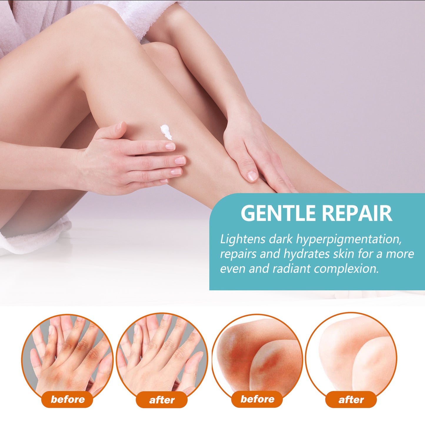 EELHOE Black Echinacea Repair Cream Repair Underarms Arms Knees Joints Dark Moisturizing Whitening Body Cream