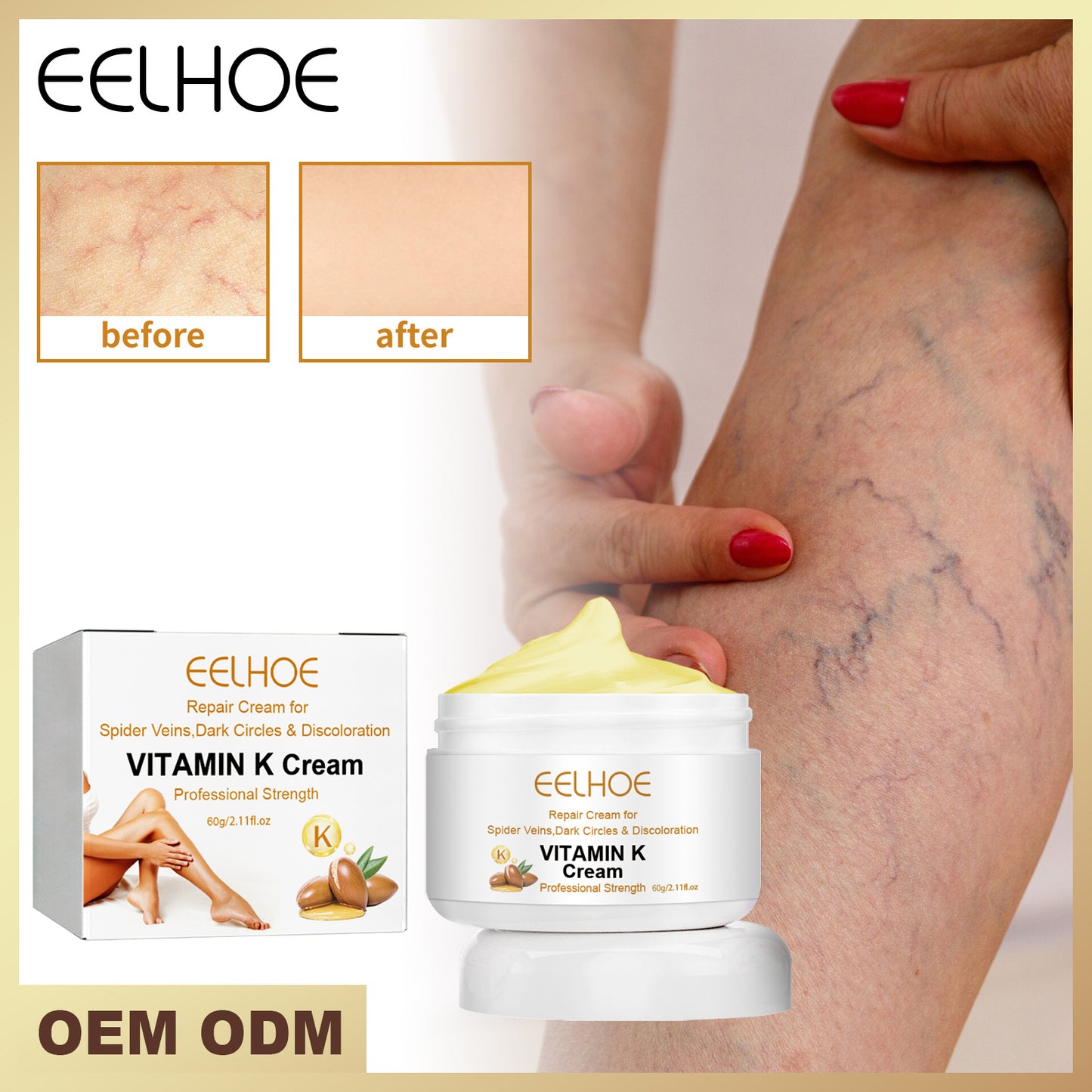 EELHOE Vitamin K Cream