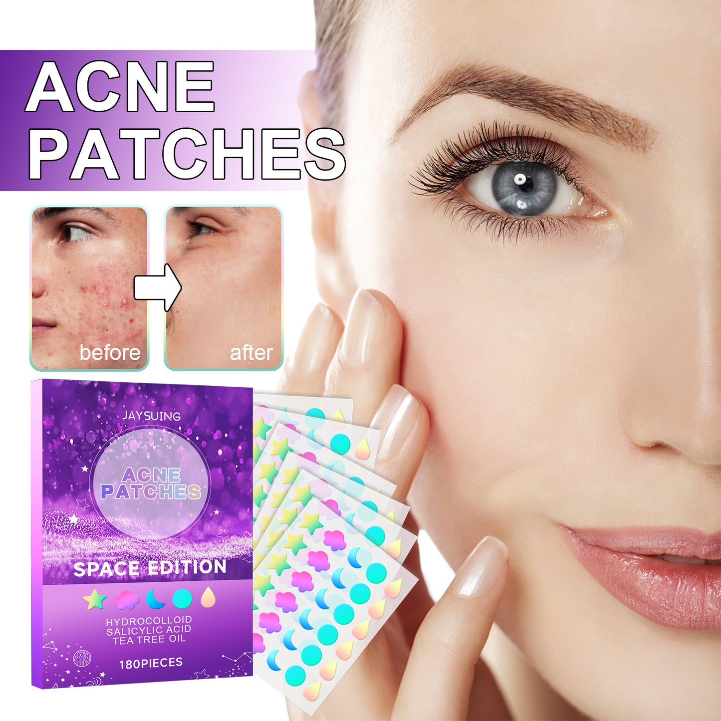 Diminish Facial Acne And Pimple Patches