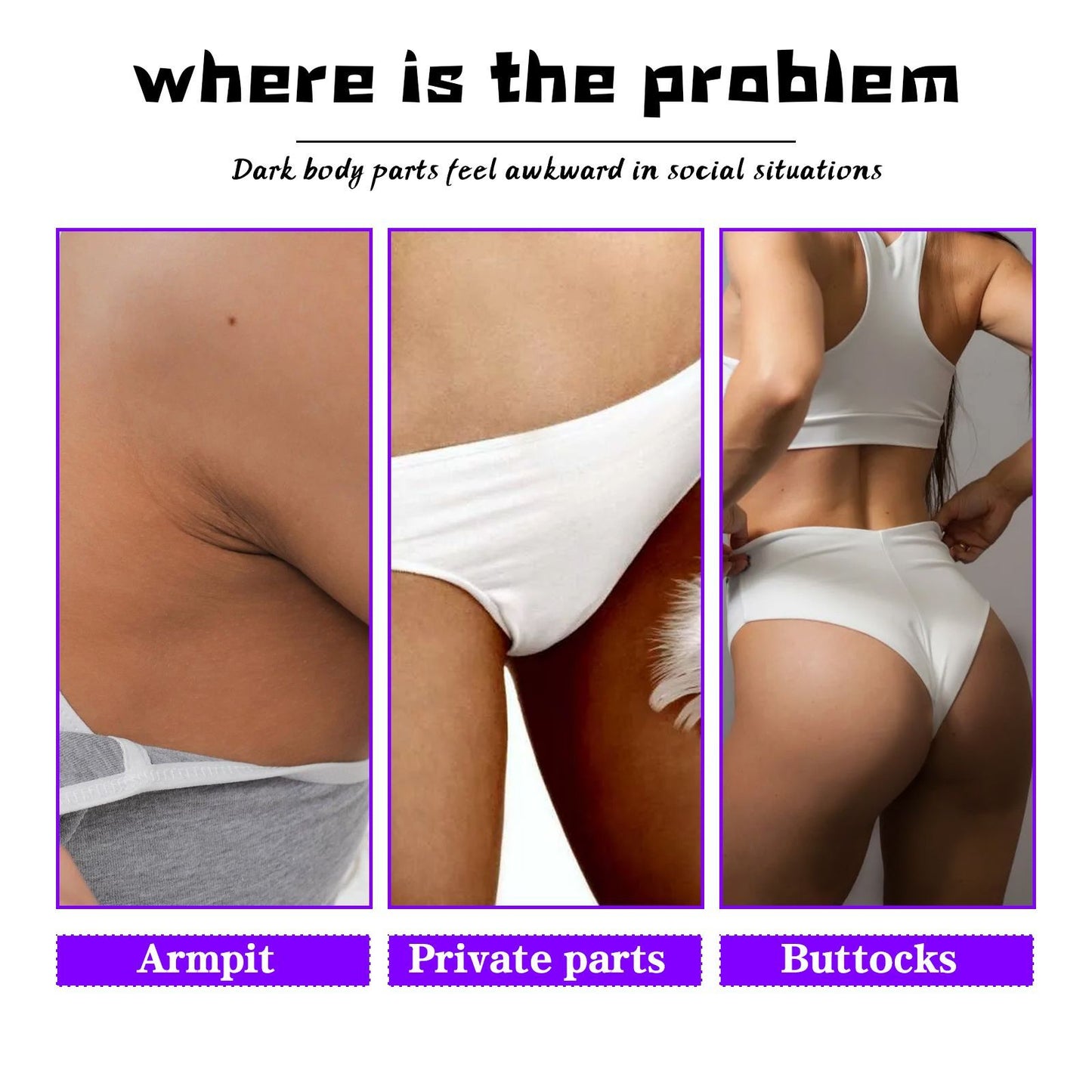 OUHOE Inner Thigh Skin Perfecting Cream Lightens Melanin Deposits On Inner Thighs, Moisturizes And Brightens Skin